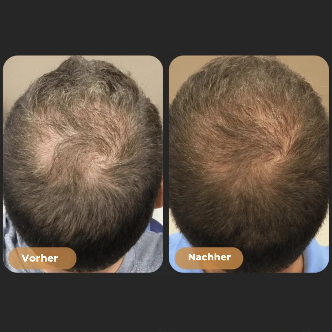 NJORDIS - Wurzelaktivator-Conditioner gegen Haarausfall bei Männern