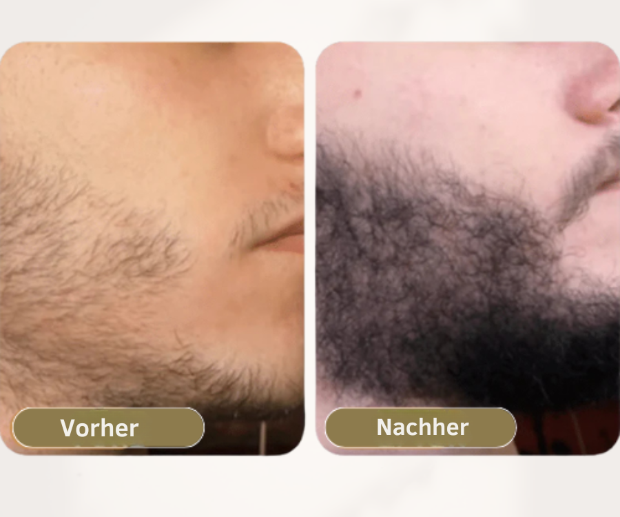Njordis™ – Ansatz-Aktivierungsspray & Bartwuchs-Set